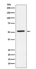 Western blot analysis of TrpRS expression in HeLa cell lysate.