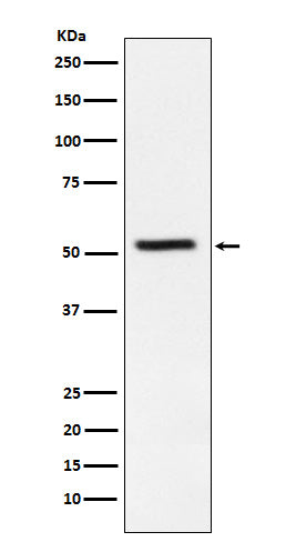 Western blot analysis of TrpRS expression in HeLa cell lysate.