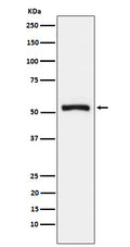 Western blot analysis of Tryptophanyl tRNA synthetase expression in 293T cell lysate.