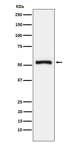 Western blot analysis of Tryptophanyl tRNA synthetase expression in 293T cell lysate.