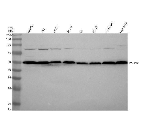 Anti-PABPN1 Rabbit Monoclonal Antibody