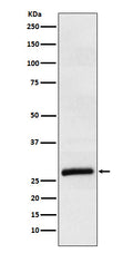 Western blot analysis of ApoM expression in Human plasma lysate.
