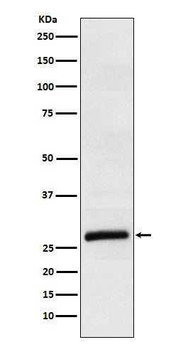Western blot analysis of ApoM expression in Human plasma lysate.