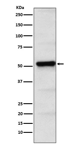 Western blot analysis of PICK1 expression in HeLa cell lysate.