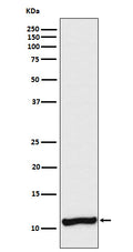 Western blot analysis of Cellubrevin expression in A375 cell lysate.