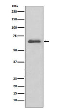 Western blot analysis of SGK1 expression in A431 cell lysate.