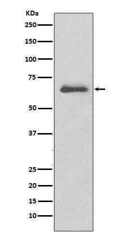 Western blot analysis of SGK1 expression in A431 cell lysate.