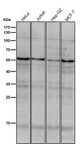 All lanes use the Antibody at 1:1K dilution for 1 hour at room temperature.