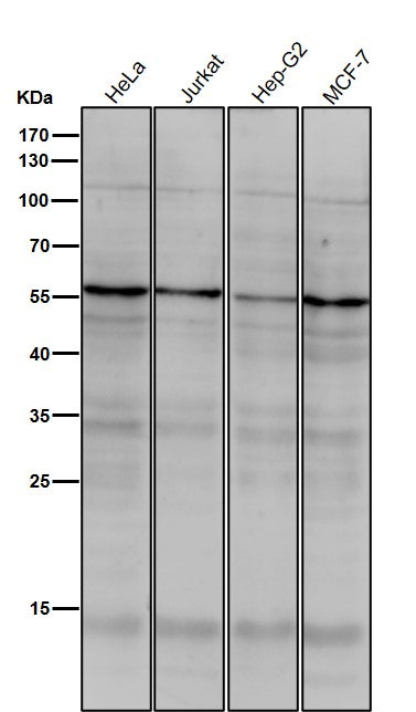 All lanes use the Antibody at 1:1K dilution for 1 hour at room temperature.