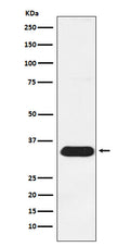 Western blot analysis of Syntenin expression in HeLa cell lysate.