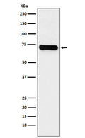 Western blot analysis of LysRS expression in Jurkat cell lysate.