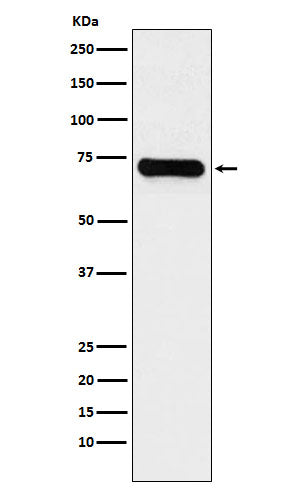 Western blot analysis of LysRS expression in Jurkat cell lysate.