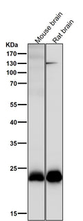 All lanes use the Antibody at 1:1K dilution for 1 hour at room temperature.