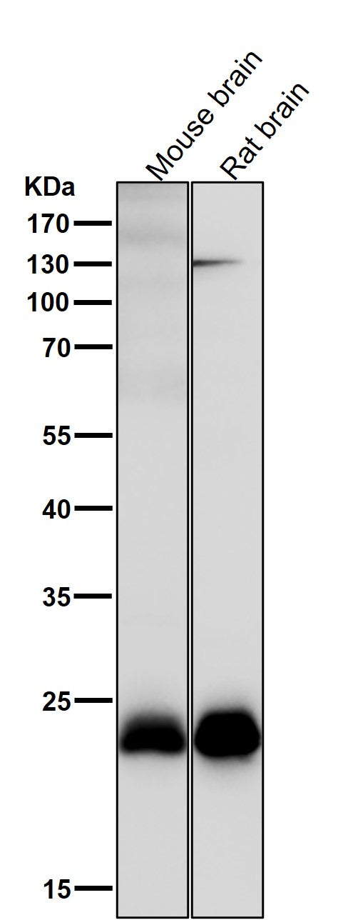 All lanes use the Antibody at 1:1K dilution for 1 hour at room temperature.