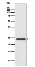 Western blot analysis of HSPB8/HSP22 expression in Human fetal heart lysate.