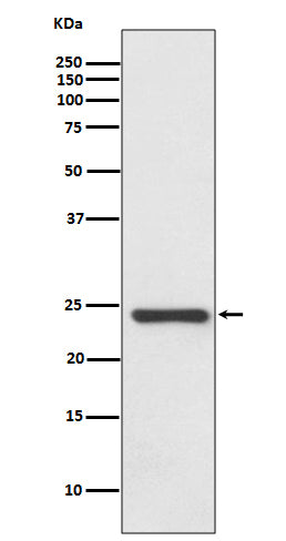 Western blot analysis of HSPB8/HSP22 expression in Human fetal heart lysate.