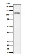 Western blot analysis of Semaphorin 4D / CD100 expression in SH-SY5Y cell lysate.