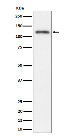 Western blot analysis of Semaphorin 4D / CD100 expression in SH-SY5Y cell lysate.
