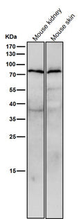 All lanes use the Antibody at 1:3K dilution for 1 hour at room temperature.