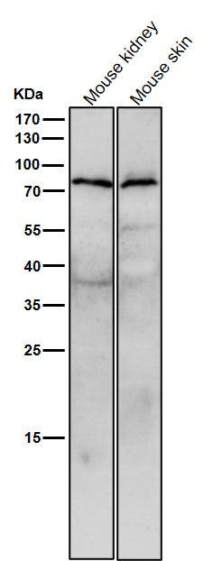 All lanes use the Antibody at 1:3K dilution for 1 hour at room temperature.