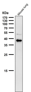 All lanes use the Antibody at 1:1K dilution for 1 hour at room temperature.
