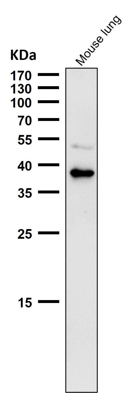 All lanes use the Antibody at 1:1K dilution for 1 hour at room temperature.