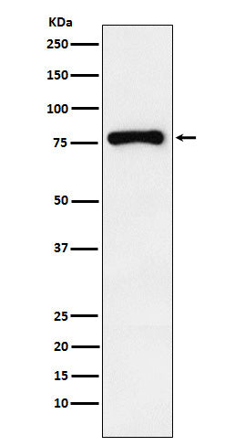 Western blot analysis of RNase L expression in THP1 cell lysate.