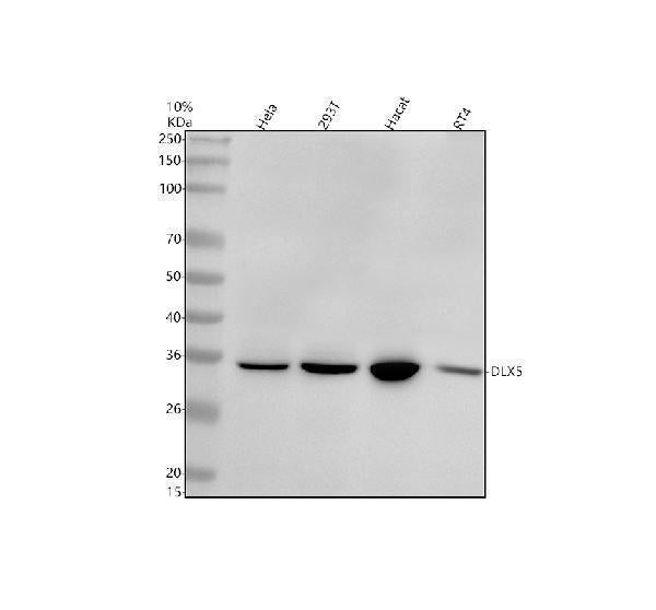 Anti-Dlx5 Rabbit Monoclonal Antibody
