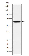 Western blot analysis of GRB7 expression in A431 cell lysate.