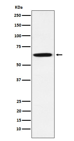 Western blot analysis of GRB7 expression in A431 cell lysate.