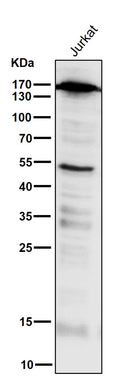 All lanes use the Antibody at 1:2K dilution for 1 hour at room temperature.