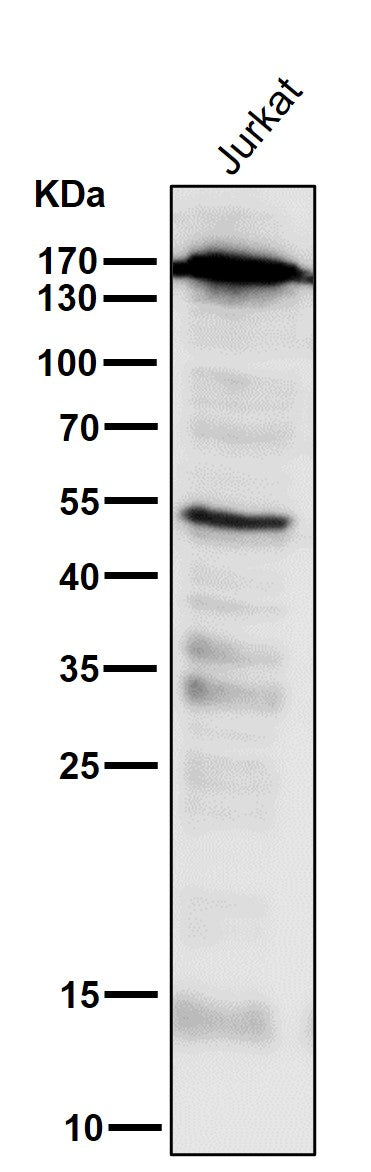 All lanes use the Antibody at 1:2K dilution for 1 hour at room temperature.