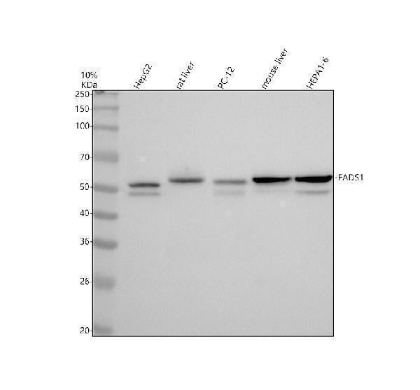 Anti-FADS1 Rabbit Monoclonal Antibody