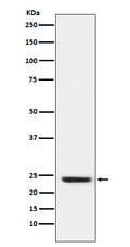 Western blot analysis of FNDC5 expression in Rat muscle cell lysate.
