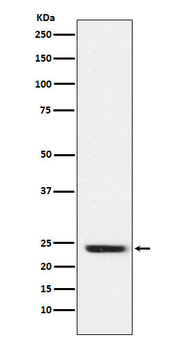 Western blot analysis of FNDC5 expression in Rat muscle cell lysate.