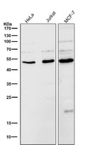 All lanes use the Antibody at 1:5K dilution for 1 hour at room temperature.