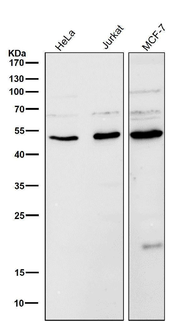 All lanes use the Antibody at 1:5K dilution for 1 hour at room temperature.