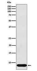 Western blot analysis of beta Defensin 1 expression in Human recombinant beta Defensin 1 lysate.