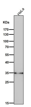 All lanes use the Antibody at 1:3K dilution for 1 hour at room temperature.