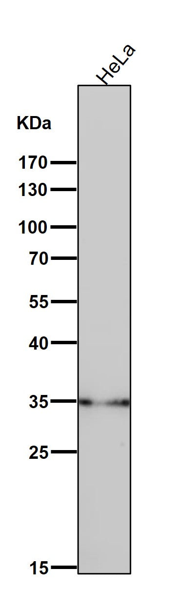 All lanes use the Antibody at 1:3K dilution for 1 hour at room temperature.
