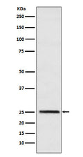 Western blot analysis of Triosephosphate isomerase expression in HeLa cell lysate.