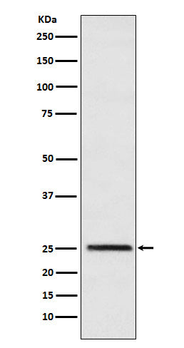 Western blot analysis of Triosephosphate isomerase expression in HeLa cell lysate.