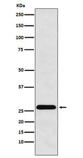 Western blot analysis of HLA-DRB4 expression in Raji cell lysate.
