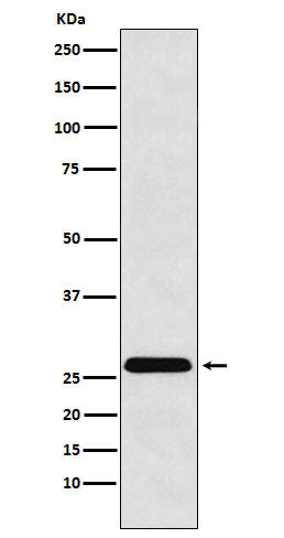 Western blot analysis of HLA-DRB4 expression in Raji cell lysate.