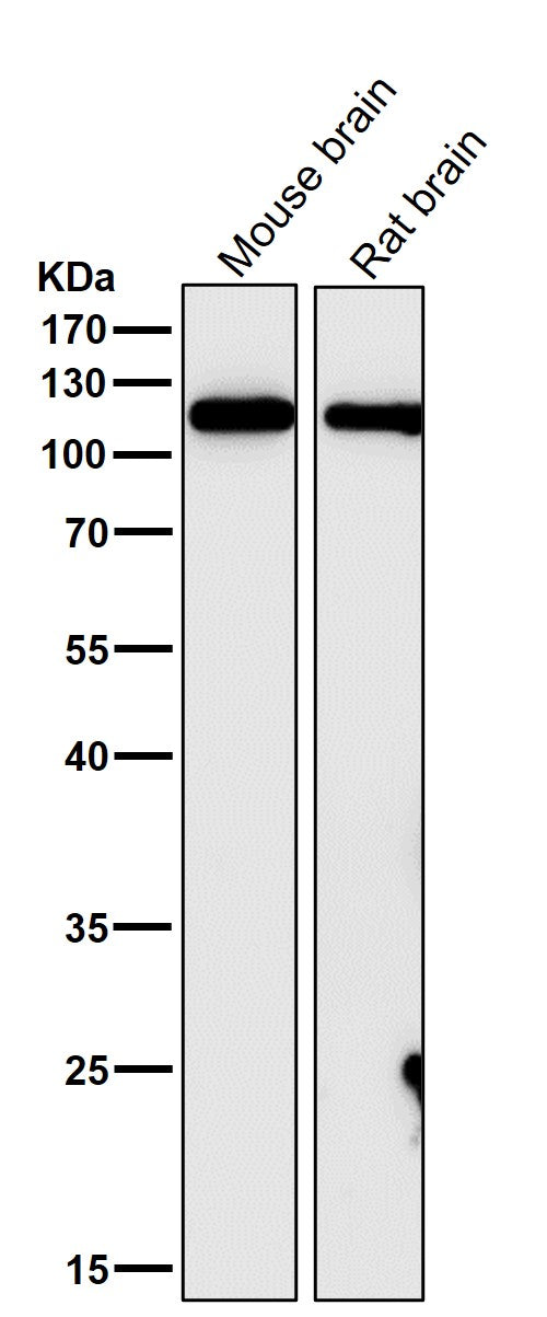 All lanes use the Antibody at 1:1W dilution for 1 hour at room temperature.
