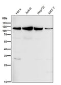 All lanes use the Antibody at 1:1K dilution for 1 hour at room temperature.