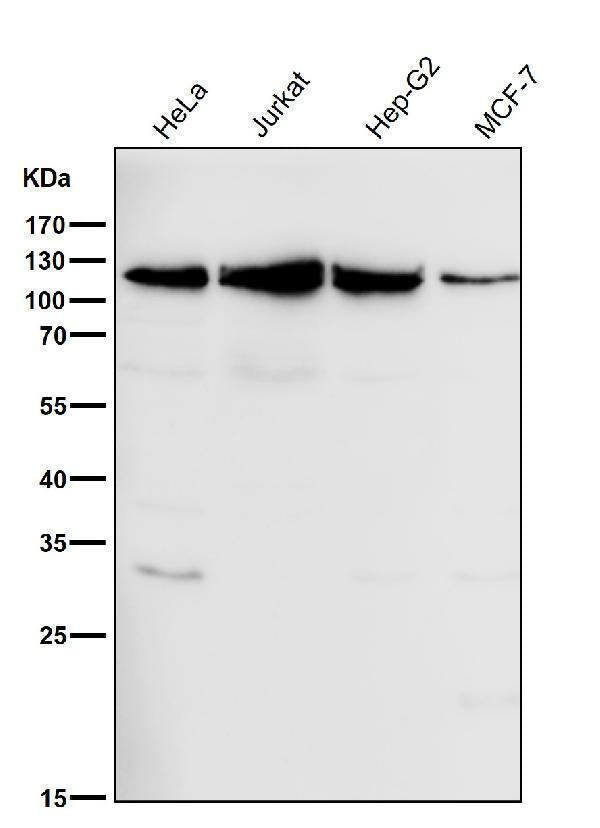 All lanes use the Antibody at 1:1K dilution for 1 hour at room temperature.