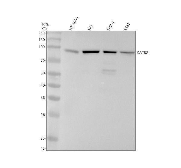 Anti-SATB2 Rabbit Monoclonal Antibody
