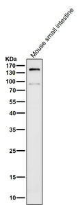 All lanes use the Antibody at 1:2K dilution for 1 hour at room temperature.