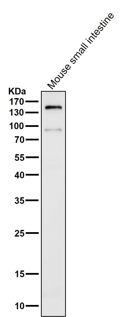 All lanes use the Antibody at 1:2K dilution for 1 hour at room temperature.